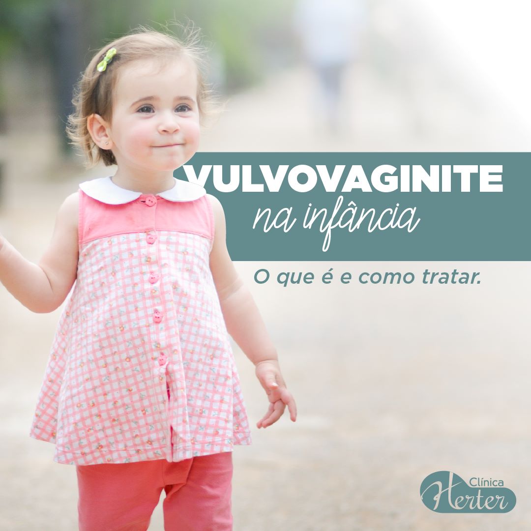 Vulvovaginite na infância